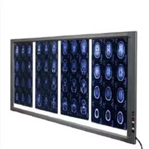 فروش نگاتوسکوپ چهار خانه LED