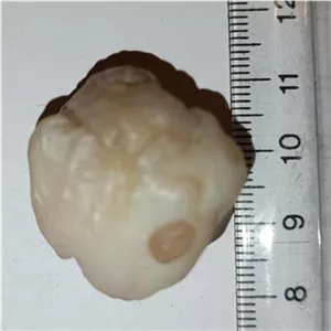 سنگ مهره فسیل زوعه چرب درشت