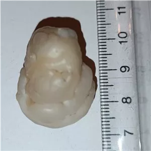 سنگ مهره فسیل زوعه چرب درشت مصور
