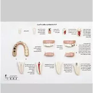 مولاژ مراقب دندان های خود باشید