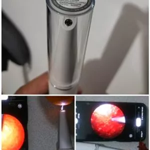 جرمگیر دوربین دار دندان خانگی Sunuo T12 Pro 