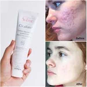 کرم ترمیم کننده پوست سیکالفیت پلاس اون Avene
