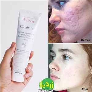 کرم ترمیم کننده اون 100 میل CICALFATE PLUS