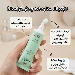 کرم ضد جوش و کنترل کننده چربی تراست