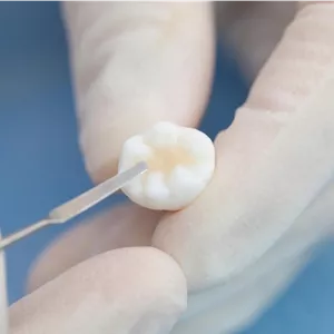 کامپوزیت 4گرمی یونیورسال VinciSmile 