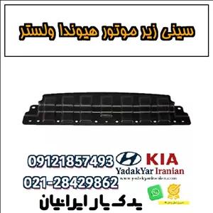 سینی زیر موتور هیوندا ولستر