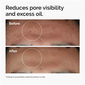 سرم نیاسینامید 10%زینک 1% اوردینری 30 میل | کنترل چربی و ضد جوش
