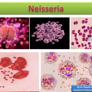 پاورپوینت خصوصیات و ویژگی کلی نایسریا ها