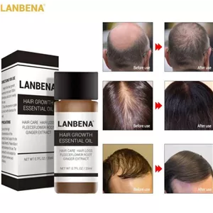 سرم تقویت کننده و محرک رشد مو لانبنا LANBENA اصلی