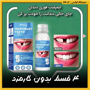ایمپلنت فوری دندان / جای خالی دندانت را خودت پر کن ( نقد و اقساط ) پروتز جادویی TEMPORARY TEETH اصل 