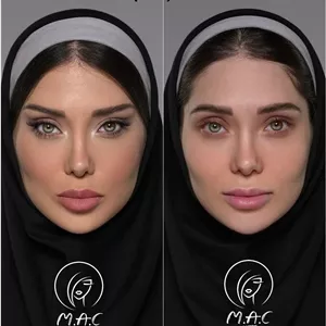 پک ویژه۶۶عددی چسب لیفت صورت ماندگاری 20 ساعته