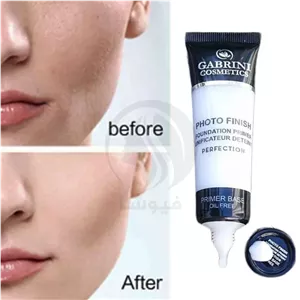 پرایمر گابرینی (Gabrini Primer)