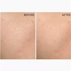 پرایمر صورت مات فینیش لولیس | 35 میل