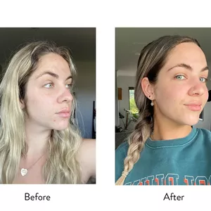 اسپری آب معدنی اون  Avène Thermal Spring Water Spray