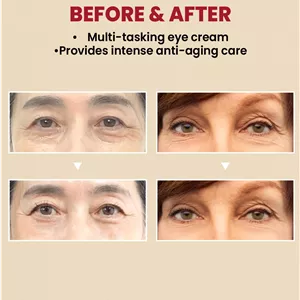 کرم دورچشم سئول رِتینَل  Seoul Retinol Eye Cream