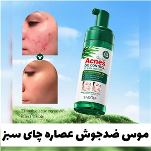 موس صورت ضد جوش عصاره چای سبز