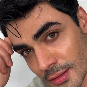 لنز رز ارکید گرین سبز دوردار