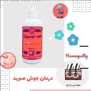 قطره گیاهی رفع دائمی جوش و جای جوش صورت 60 سی سی هومیو پاتی