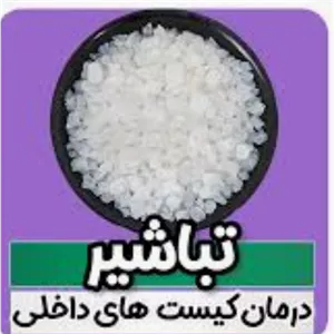 صمغ تباشیر (طباشیر) درمان کیست تخمدان
