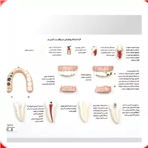 مدل آموزشی  مراقبت از دندان