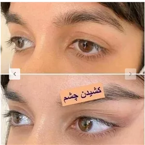 چسب لیفت صورت و شقیقه 40 عددی (دارای کش تنظیم سایز)