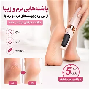 سنگ پای شارژی، مراقبت حرفه ای از پا در خانه