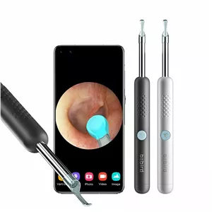 گوش پاک کن هوشمند شیائومی Bebird R1 با دوربین 1080p و زاویه دید 360 درجه