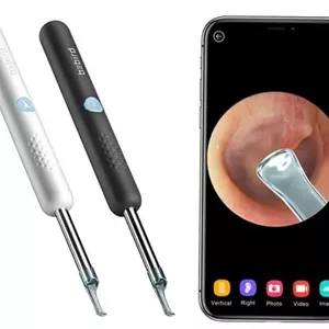 دستگاه آندوسکوپی و پاک کننده داخل گوش شیائومی Xiaomi Bebird R1