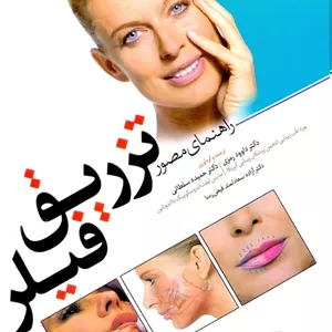 راهنمای مصور تزریق فیلر رمزی آبادیس طب