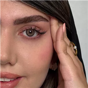 لنز رز آلیس براون قهوه ای عسلی