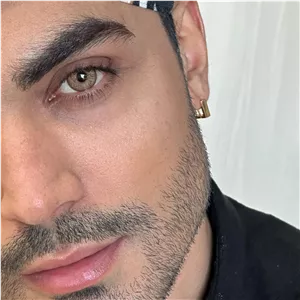 لنز یونیک فلامینگو عسلی دور دار