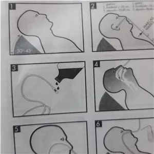 سوند معده سیلیکونی 14 بکسن