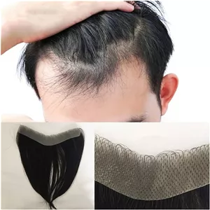 پروتز مو جلوسر مردانه وارداتی کد 73
