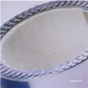 المنت حلقه